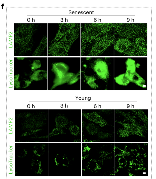 衰老细胞里的溶酶体又多又亮（参考资料[1]）